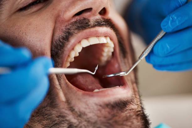 Best Emergency Broken Tooth Repair in Westchester, FL